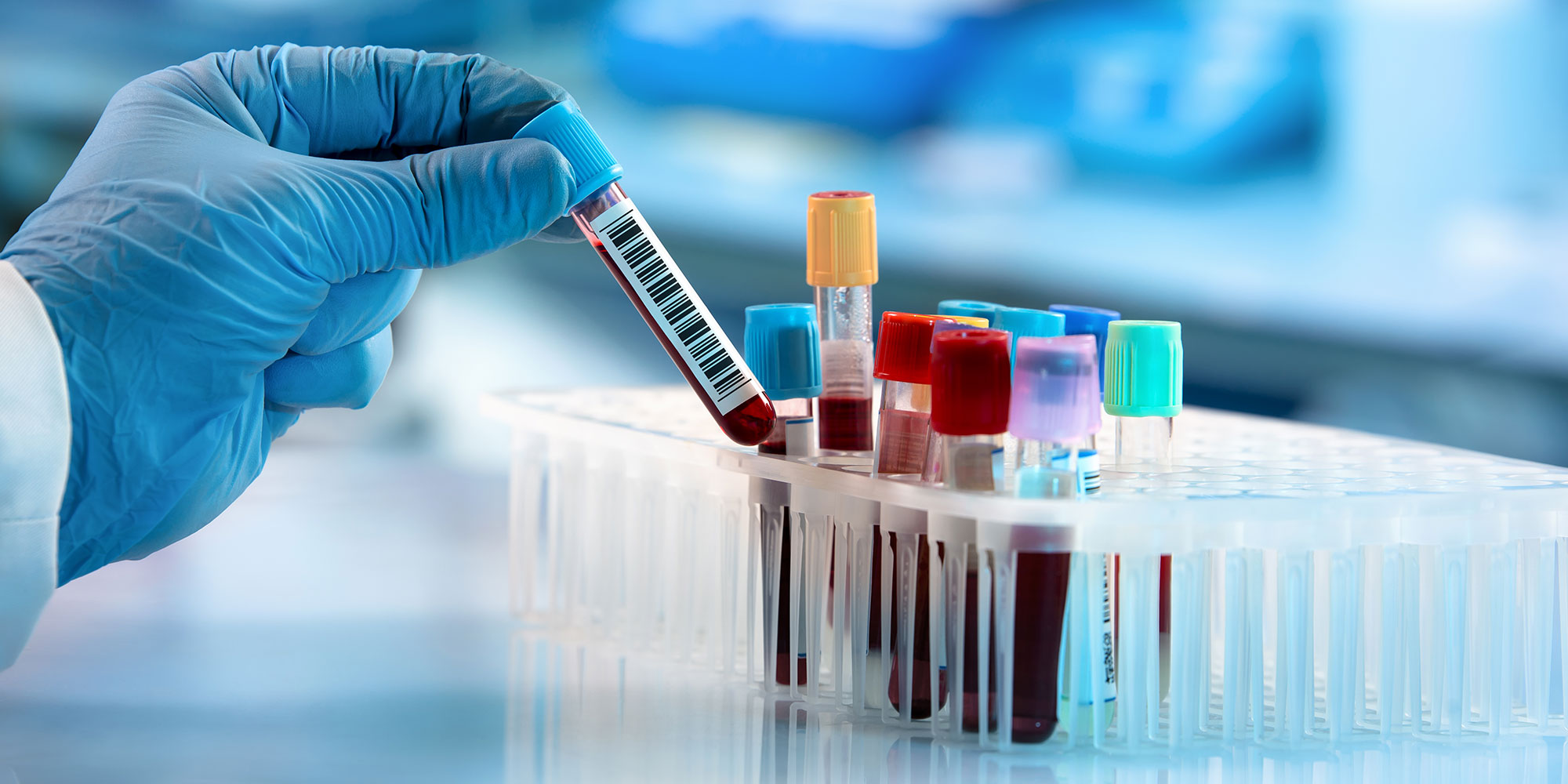 physician handling blood work in lab